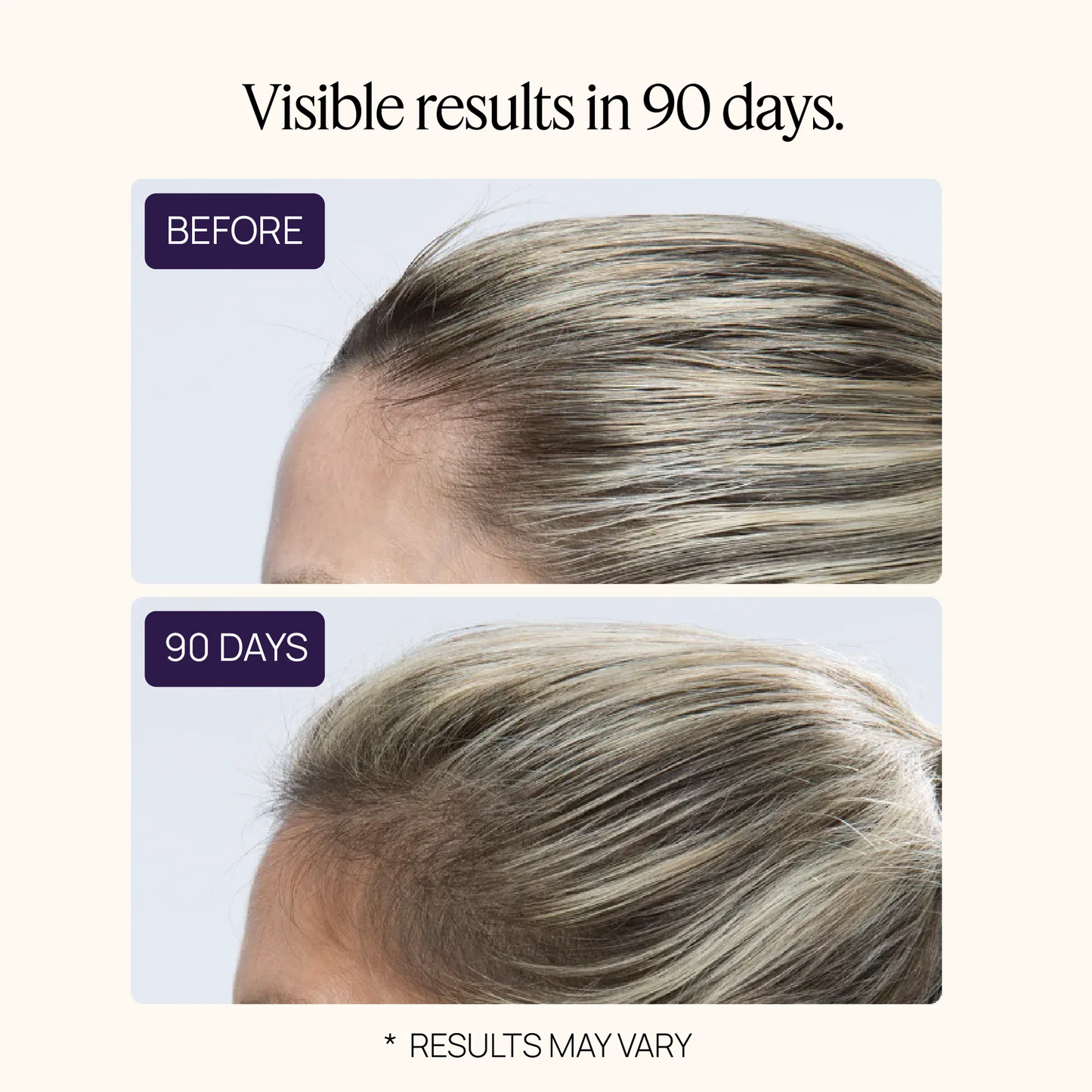 Hair Growth Peptides Gummies